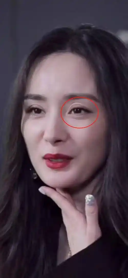 杨幂的眼睛怎么了?