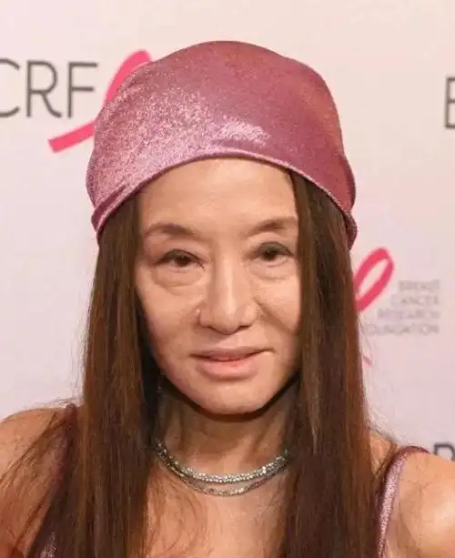 然而,她在好友的生日照片中却惊讶地发现自己皮肤松弛下垂,皱纹明显