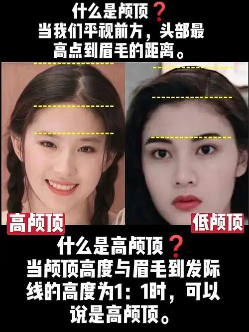 低颅顶也能当美女75别再审美迷信75