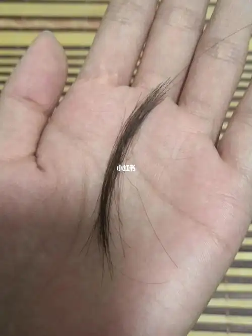 睡一觉起来头发断了一撮