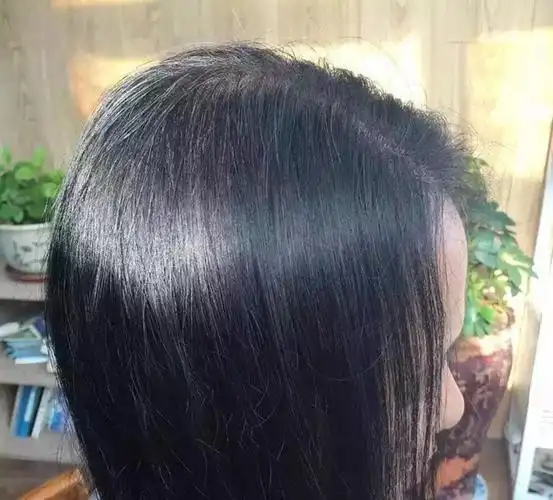 有白头发怎么办,都怎么解决的啊,我有白发(女),求方法求方法求方法