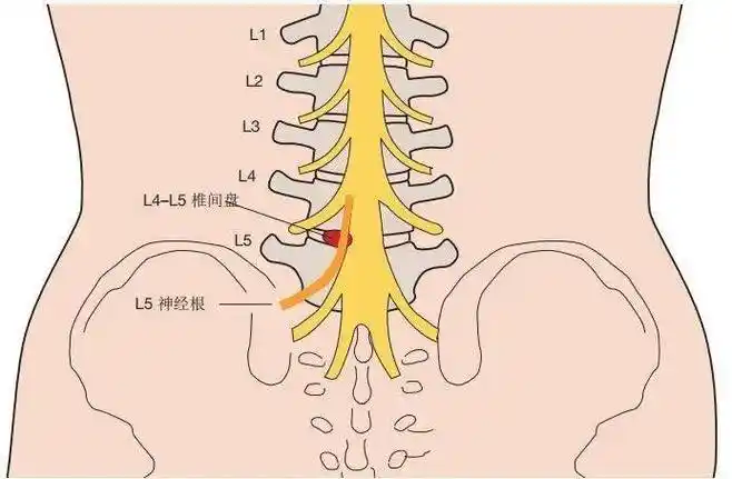 腰骶椎特殊检查_手机搜狐网