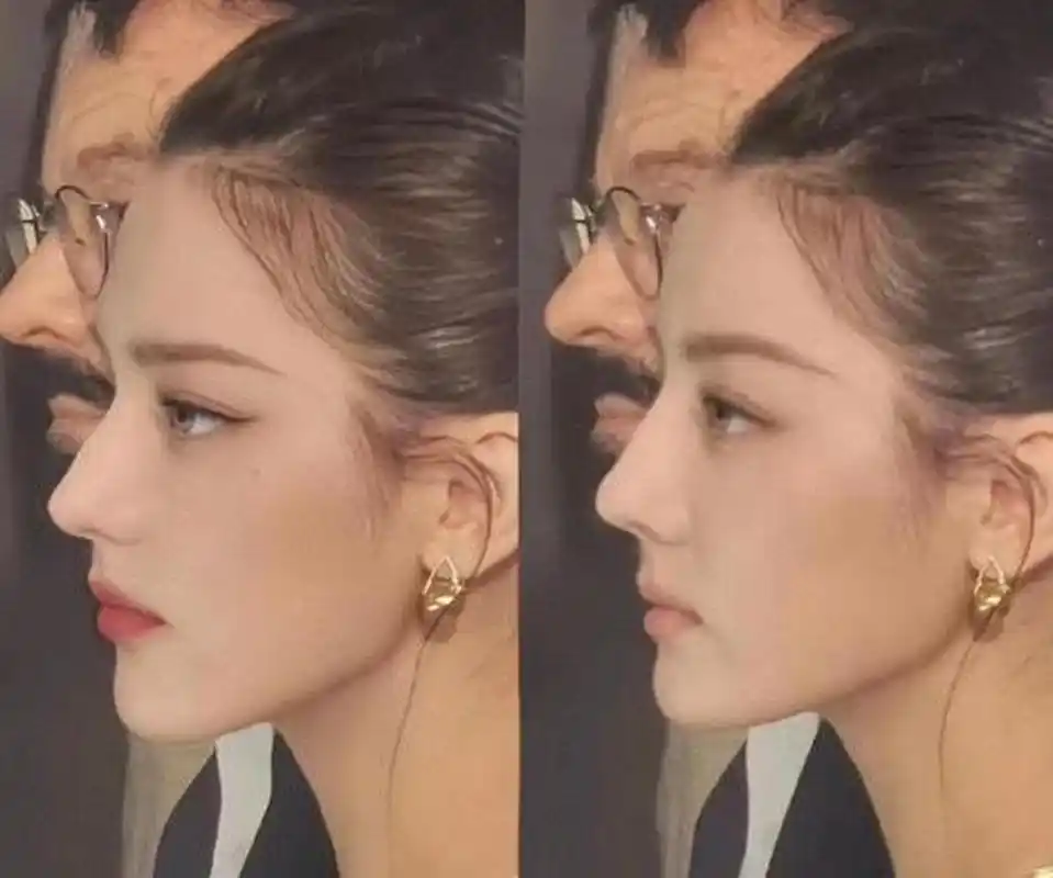 网友给迪丽热巴p的侧颜,感觉p丑了[吃瓜群众]