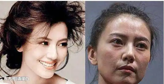 女明星卸妆后,孙怡皮肤乌黑,高圆圆老了十岁,章子怡不同最大!