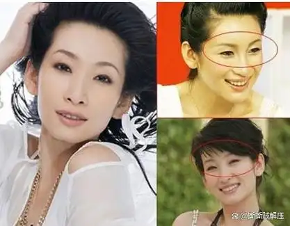 有的人看起来比较明显,而有的人却毫无整容痕迹.