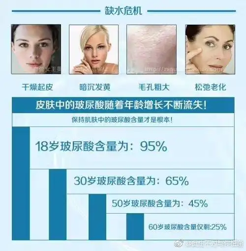 你知道什么是玻尿酸吗