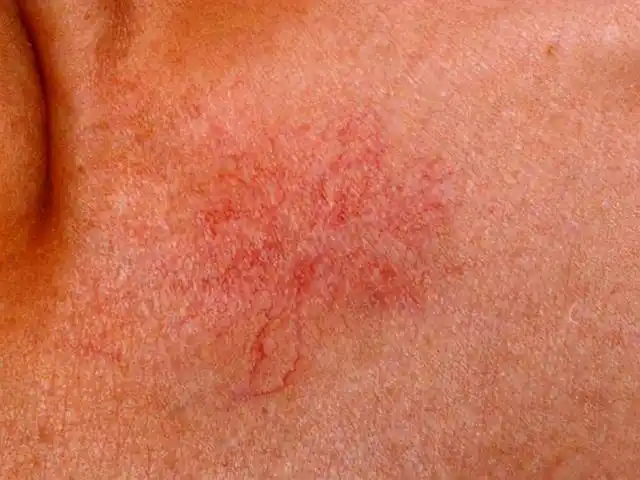 肝癌很会伪装提示这4类人群要注意常喝酒的人也在内