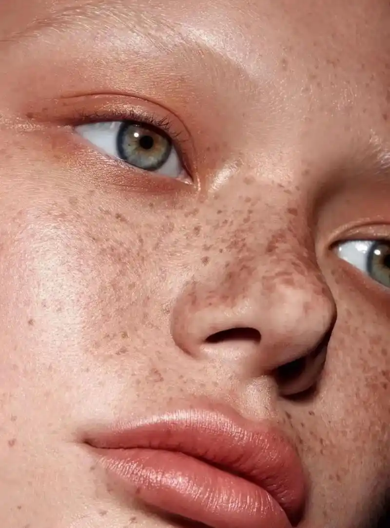 长斑原理 当皮肤代谢缓慢时,黑色素就会堆积!# - 抖音