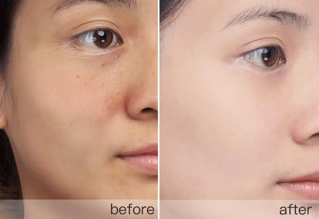 被古巨基守护24年的她,52岁嫩成18岁,全靠这个小习惯!