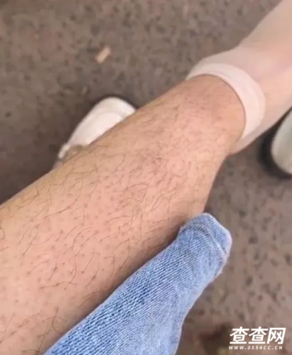 女生的腿毛可以有多长,你们认为的女生的腿毛是什么样的?