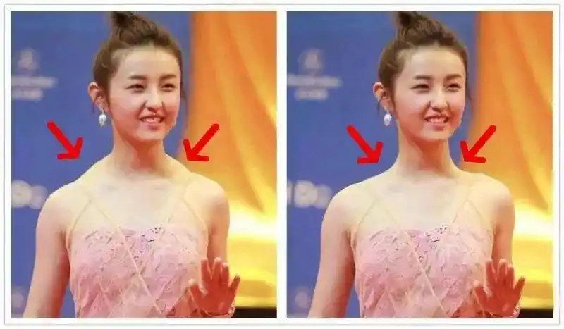 张子枫肩部斜方肌凸出,把肩膀p挺,气质大不同所以你看,气质对一个人