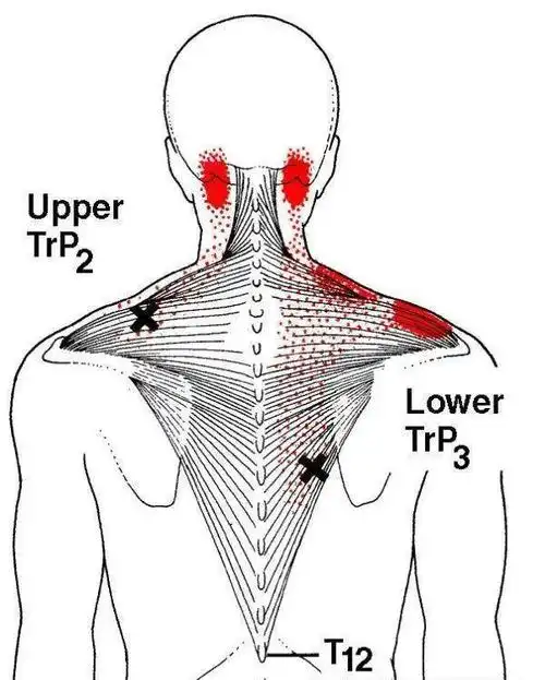 如果你的斜方肌很紧张很硬,不建议一上来就拉伸,可能此时肌肉粘滞度较