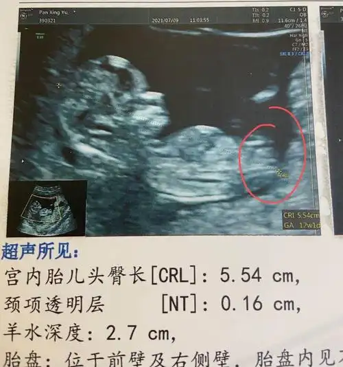 nt通过啦!有伙伴会看男女嘛