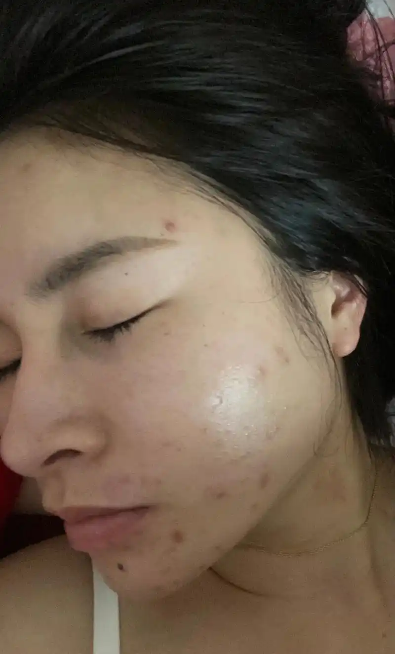 以前的皮肤真的很差,因为经常熬夜作息不规律,又不重视皮肤,所 - 抖音