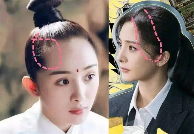 杨幂发际线前后对比照,杨幂植发前后对比惊人-图片大观-奇异网