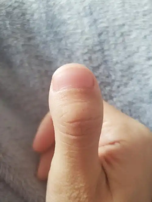 分享我的丑手指头