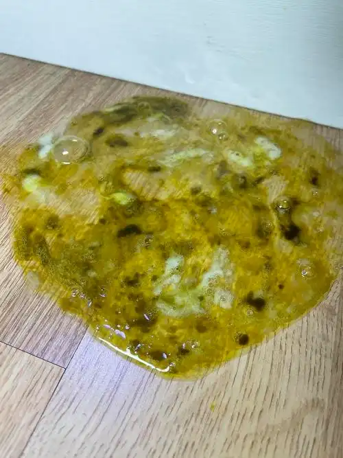 胰腺炎呕吐出胆汁和黑色黏膜类物质有图