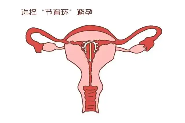 对于避孕方式,你更钟爱哪一种?