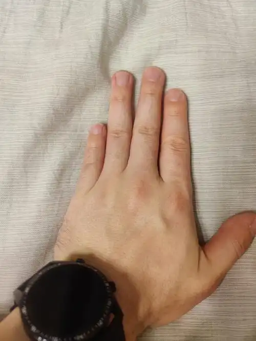 我这手指短的,弹吉他还有的救嘛?#吉他学习