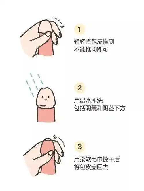 男宝宝有 3 种,女宝宝有 6 种_包皮_蛋蛋_阴囊