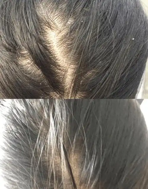 去头皮屑的洗发水什么牌子好