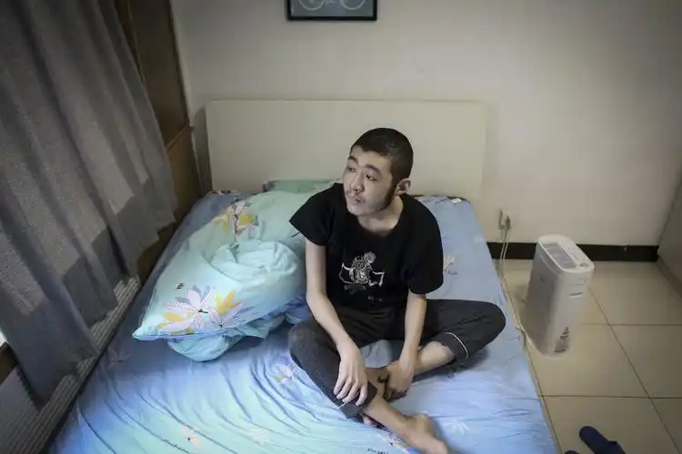 福建一17岁男孩患重症后"容貌大变",帅小伙被整成了中年大叔