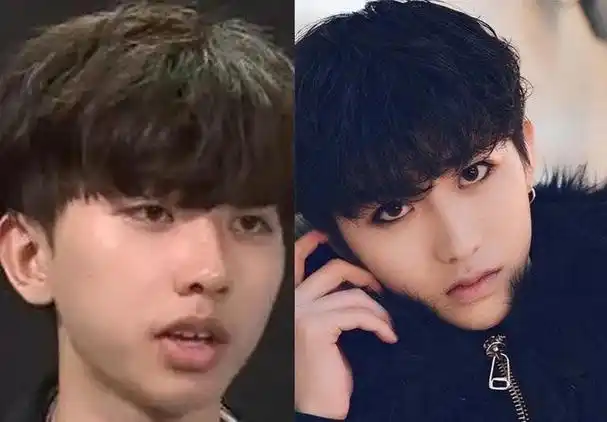 歌声更是让人头皮发麻,整容医院除了放出华晨宇的植发照片,还爆料他长