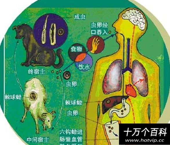 1,乳房血吸虫病;2,乳房肺吸虫病;3,乳房裂头蚴病;4,乳房包虫病;5,乳房