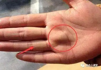 肿瘤科专家说,手这里摸到有硬块,可能是癌变征兆,万万要小心了!