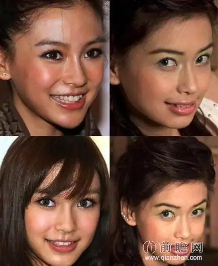 angelababy整容照(angelababy整牙前后对比照)(3)