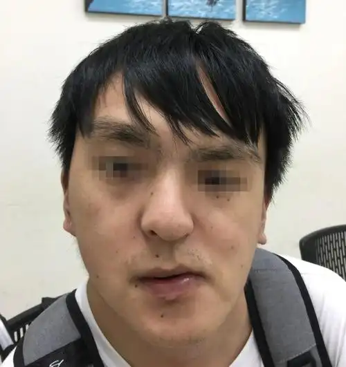 歪脸形成有哪些原因?又应该如何矫正?