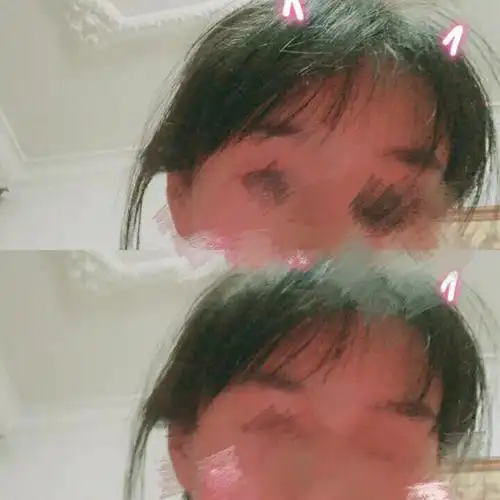 头发被打薄现在稀少成这个鬼样丑得不想见人了