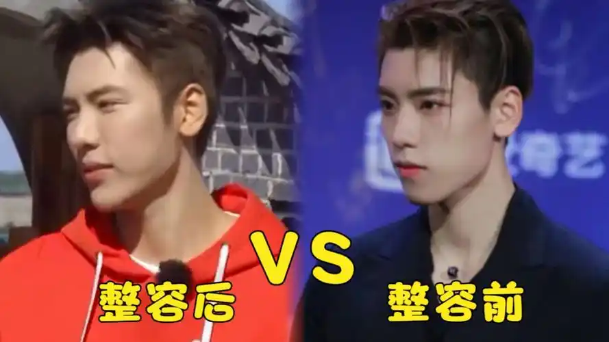 王子异整容失败引热议!综艺截图大变脸,脸肿下巴鼓颜值大跌