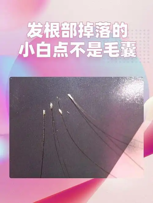 毛囊的这些知识,你应该知道