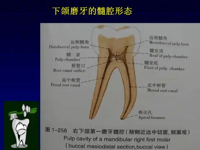 口腔解剖生理学下颌磨牙的髓腔形态