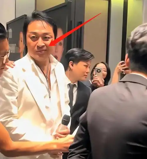 61岁马景涛被疑中风,左脸歪斜右脸肿,和小25岁娇妻结婚压力大