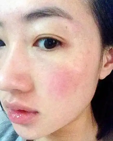 有了这些肌肤问题很烦恼_皮肤