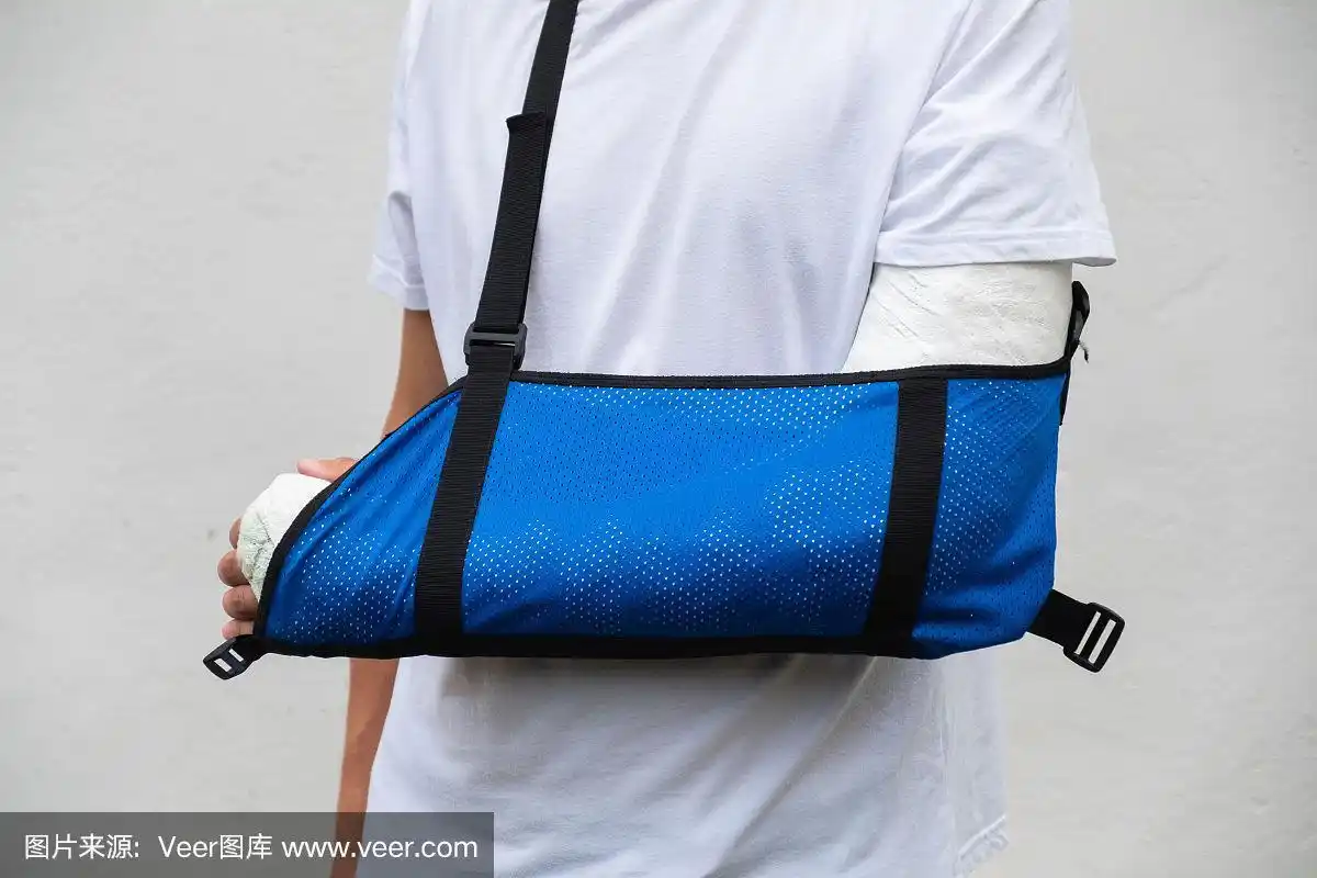 手臂骨折的男子,身上裹着医用石膏和蓝色绷带.