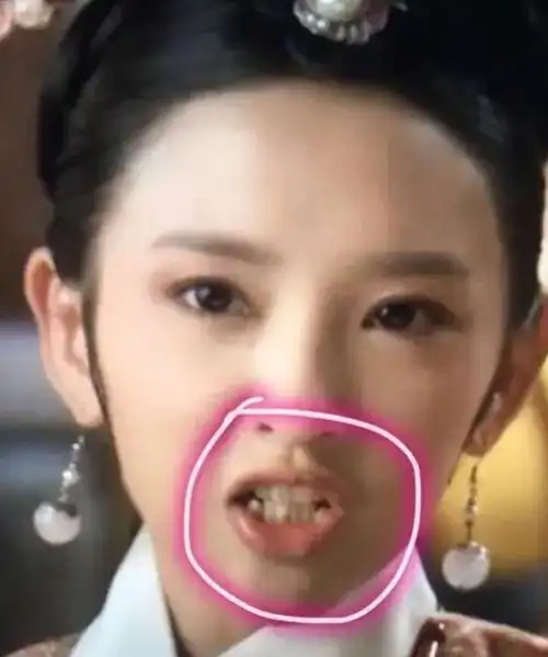 杨紫酒窝消失,刘涛牙龈发灰,这6位女星被整牙"毁"了颜值_网易订阅