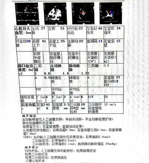 经典病例周周谈丨广东省人民医院罗建方主任李捷主任团