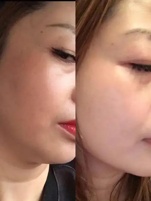 本草面膜可以改善皮肤暗黄吗 能不能让皮肤变得嫩白