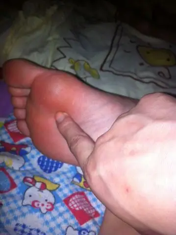 脚底痛,好苦恼,一直困扰我的生活,跪求各路大仙帮忙,告诉我这是怎么了