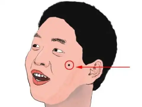 左颧骨有痣的男人运势好吗