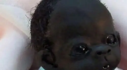 世界上最黑的小宝宝,如今5年过去,长大后却成这样了