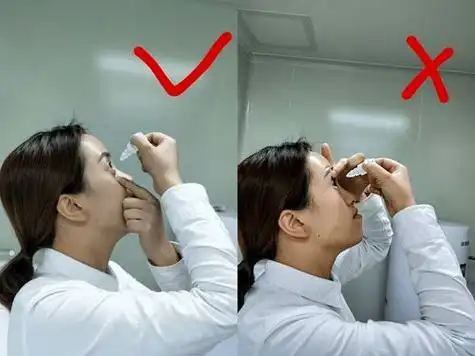 【科普时刻】一分钟,学会正确滴眼药水_眼睛_结膜_眼睑