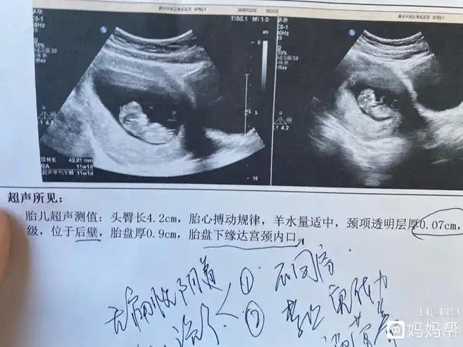 幸运!nt三个亮点是男孩女孩"囊胚培养"-第1张图片-蒲城博客