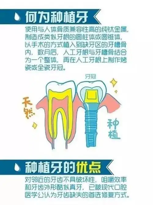 图解人类的第三幅牙齿"种植牙