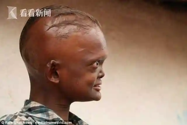 印度两兄弟长尖牙如外星人 头每半小时要浇次水