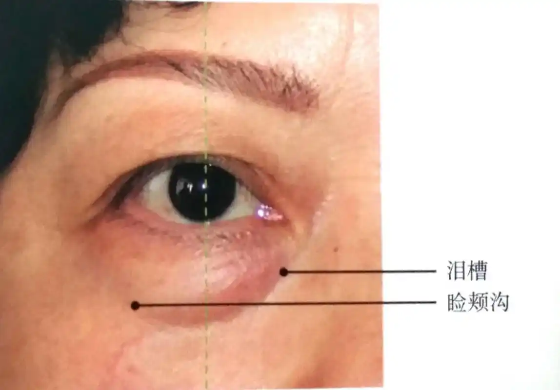 眼睑与眼周的解剖结构眼睑篇