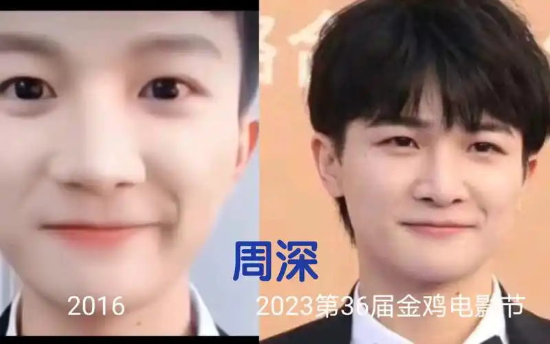 周深,看看周深整容了吗?让那些质疑的人闭嘴吧!
